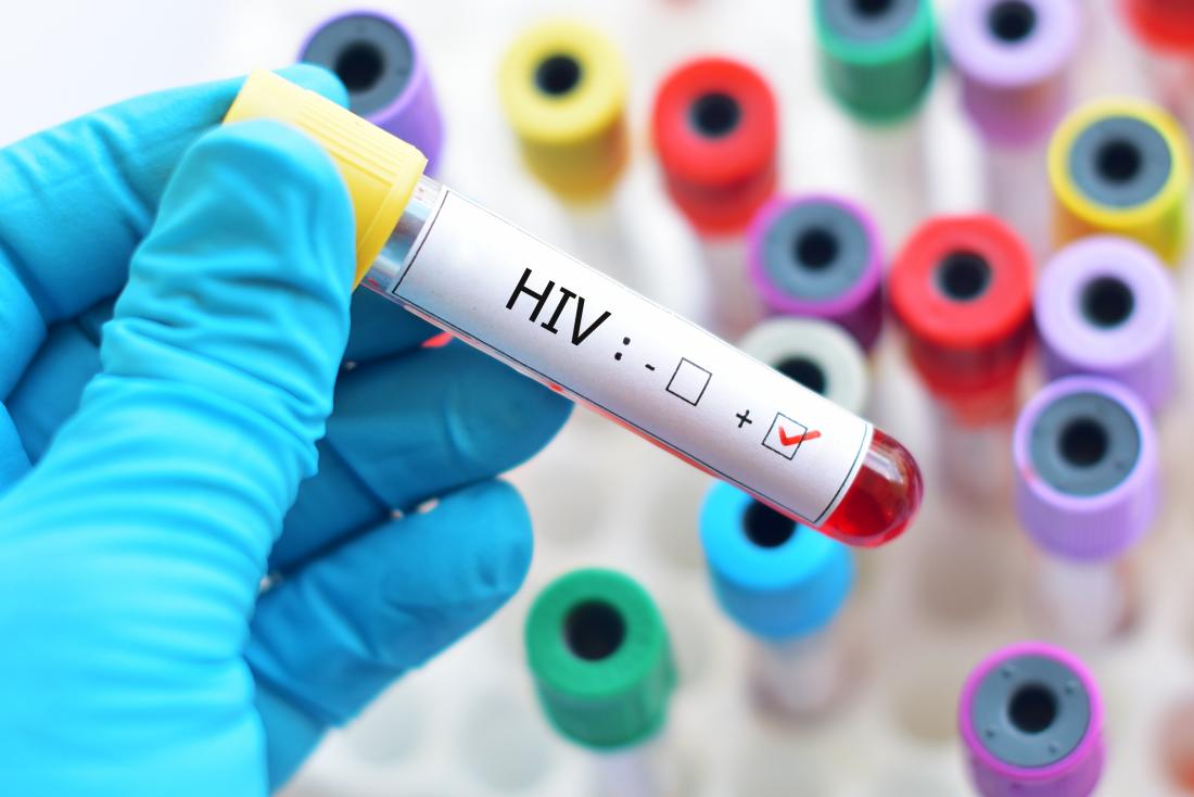 3 Gejala Penyakit HIV dan AIDS